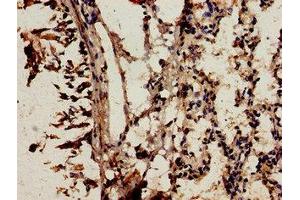 Immunocytochemistry analysis of human lung tissue using ABIN7161498 at dilution of 1:100 (NCF2 抗体  (AA 178-526))