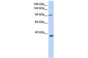 Image no. 1 for anti-Endothelial PAS Domain Protein 1 (EPAS1) (AA 360-409) antibody (ABIN6742258) (EPAS1 抗体  (AA 360-409))