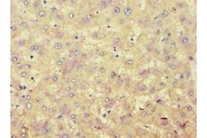 Immunohistochemistry of paraffin-embedded human liver tissue using ABIN7142945 at dilution of 1:100 (ACAT1 抗体  (AA 1-145))