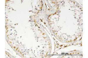Immunoperoxidase of monoclonal antibody to IL13 on formalin-fixed paraffin-embedded human testis. (IL-13 抗体)