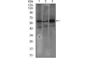 Western blot analysis using FCER1A mouse mAb against SW620 (1), A549 (2), and A431 (3) cell lysate. (Fc epsilon RI/FCER1A 抗体  (AA 42-103))