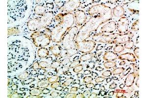 Immunohistochemical analysis of paraffin-embedded human-kidney, antibody was diluted at 1:200 (Angiotensin I Converting Enzyme 1 抗体  (AA 41-90))