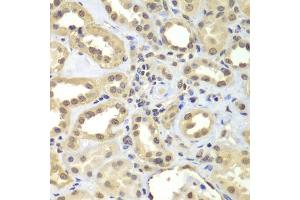 Immunohistochemistry of paraffin-embedded human kidney using SUPT20H antibody (ABIN5975125) at dilution of 1/100 (40x lens). (FAM48A/P38IP 抗体)
