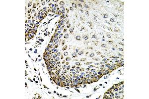 Immunohistochemistry of paraffin-embedded human esophagus using SDC2 antibody (ABIN3022587, ABIN3022588, ABIN3022589 and ABIN6218928) at dilution of 1:100 (40x lens). (Syndecan 2 抗体  (AA 19-144))