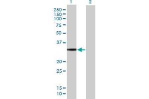 Western Blotting (WB) image for anti-Guanine Nucleotide Binding Protein (G Protein), alpha Activating Activity Polypeptide O (GNAO1) (AA 1-302) antibody (ABIN516103)