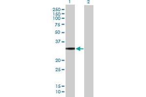 Western Blot analysis of GNAO1 expression in transfected 293T cell line by GNAO1 MaxPab polyclonal antibody. (GNAO1 抗体  (AA 1-302))