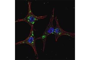 Fluorescent confocal image of HeLa cells stained with SYVN1 antibody.