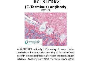 Image no. 1 for anti-SLIT and NTRK-Like Family, Member 2 (SLITRK2) (C-Term) antibody (ABIN1739438) (SLITRK2 抗体  (C-Term))