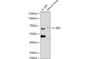 Western blot analysis of extracts of various cell lines, using EED antibody  at 1:1000 dilution. (EED 抗体  (AA 1-100))