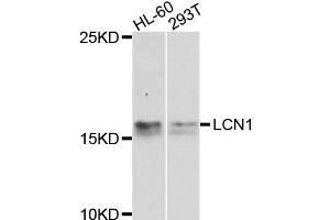 Western blot analysis of extracts of various cell lines, using LCN1 antibody. (Lipocalin 1 抗体)