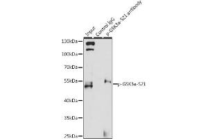 Immunoprecipitation analysis of 200 μg extracts of 293T cells, using 3 μg Phospho-GSK3α-S21 pAb (ABIN6135231, ABIN6136096, ABIN6136097 and ABIN6225606). (GSK3 alpha 抗体  (pSer21))