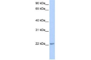 WB Suggested Anti-TCEAL2 Antibody Titration:  0. (TCEAL2 抗体  (N-Term))