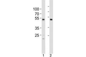 Western blot analysis of lysate from 1) HCT116 cell line and 2) human heart tissue using SOX7 antibody at 1:1000. (SOX7 抗体  (C-Term))