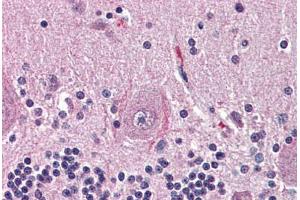 Human Brain, Cerebellum (formalin-fixed, paraffin-embedded) stained with NTSR2 antibody ABIN399994 at 10 ug/ml followed by biotinylated goat anti-rabbit IgG secondary antibody ABIN481713, alkaline phosphatase-streptavidin and chromogen. (NTSR2 抗体  (Internal Region))