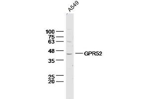 Lane 1: A549 lysates probed with Anti –GPR52 Polyclonal Antibody, Unconjugated (bs-13539R) at 1:300 overnight at 4˚C. (GPR52 抗体  (AA 151-250))