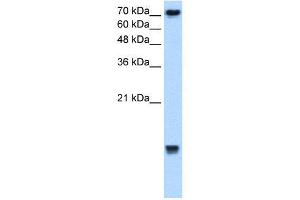 WB Suggested Anti-UBE2N  Antibody Titration: 2. (UBE2N 抗体  (Middle Region))