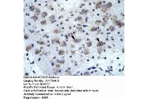 Immunohistochemistry (IHC) image for anti-Potassium Voltage-Gated Channel, Subfamily H (Eag-Related), Member 5 (KCNH5) (N-Term) antibody (ABIN2776313)