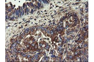 Image no. 13 for anti-Ubiquitin-Conjugating Enzyme E2, J1, U (UBE2J1) antibody (ABIN1501637)