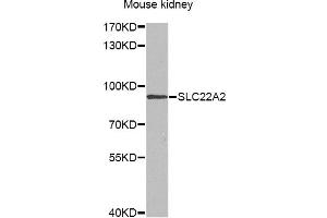 Western blot analysis of extracts of mouse kidney, using SLC22A2 antibody (ABIN6291468) at 1:1000 dilution. (SLC22A2 抗体)