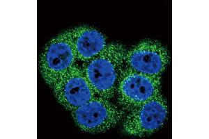 Immunofluorescence (IF) image for anti-Discoidin Domain Receptor tyrosine Kinase 1 (DDR1) antibody (ABIN3003119) (DDR1 抗体)