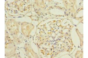 Immunohistochemistry of paraffin-embedded human kidney tissue using ABIN7170183 at dilution of 1:100 (SLC25A33 抗体  (AA 66-120))