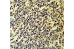 Immunohistochemistry (Paraffin-embedded Sections) (IHC (p)) image for anti-Phospholipase A2, Group VI (Cytosolic, Calcium-Independent) (PLA2G6) (AA 558-588), (Middle Region) antibody (ABIN954164)