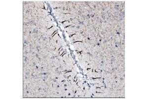 IHC analysis of Alpha Internexin/INA using anti-Alpha Internexin/INA antibody (ABIN7602187).