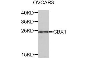 Western blot analysis of extracts of OVCAR-3 cells, using CBX1 antibody (ABIN5971253) at 1/1000 dilution. (CBX1 抗体)