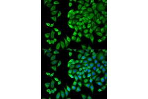 Immunofluorescence (IF) image for anti-WNK Lysine Deficient Protein Kinase 1 (WNK1) antibody (ABIN1875447) (WNK1 抗体)