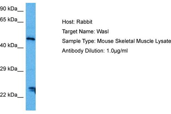 Neural Wiskott-Aldrich syndrome protein (WASL) (Middle Region) 抗体