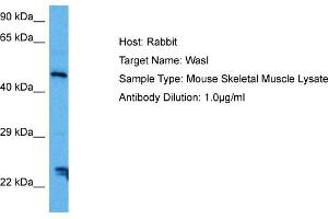 Host: Mouse Target Name: WASL Sample Tissue: Mouse Skeletal Muscle Antibody Dilution: 1ug/ml (Neural Wiskott-Aldrich syndrome protein (WASL) (Middle Region) 抗体)