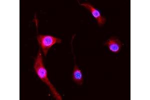IF analysis of S100A8 using anti-S100A8 antibody (ABIN3042481). (S100A8 抗体  (AA 2-89))