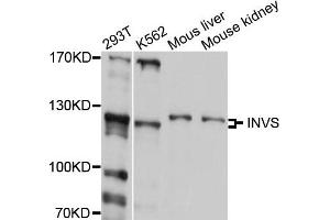 Western blot analysis of extract of various cells, using INVS antibody. (Inversin 抗体)