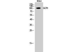 Western Blotting (WB) image for anti-Folate Hydrolase 1B (FOLH1B) (Internal Region) antibody (ABIN3175245) (FOLH1B 抗体  (Internal Region))