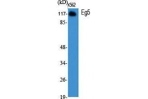 Western Blot (WB) analysis of specific cells using Eg5 Polyclonal Antibody. (KIF11 抗体  (Ser711))