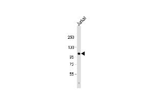 Anti-Parg Antibody (C-term) at 1:1000 dilution + Jurkat whole cell lysate Lysates/proteins at 20 μg per lane. (PARG 抗体  (C-Term))