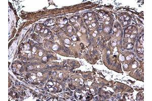 IHC-P Image MAP3K8 antibody [N3C3] detects MAP3K8 protein at cytoplasm on mouse colon by immunohistochemical analysis. (MAP3K8 抗体)