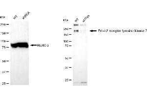 Western blotting analysis using erb-b2 receptor tyrosine kinase 2 antibody (ABIN7800158). (ErbB2/Her2 抗体)