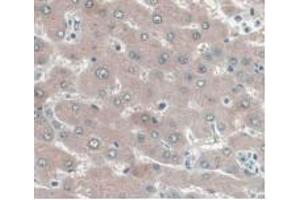 IHC-P analysis of Human Liver Tissue, with DAB staining. (UCP2 抗体  (AA 154-289))