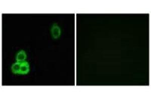 Immunofluorescence analysis of MCF-7 cells, using CELSR1 antibody.