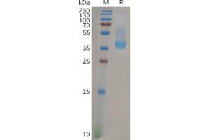 SDS-PAGE (SDS) image for Chemokine (C-X-C Motif) Receptor 4 (CXCR4) (AA 1-38) protein (Fc Tag) (ABIN6964154)