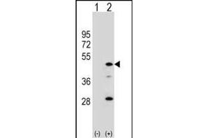 Western blot analysis of DAC (arrow) using rabbit polyclonal DAC Antibody (C-term) (ABIN390780 and ABIN2841034). (AADAC 抗体  (C-Term))