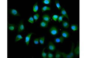 Immunofluorescence staining of A549 cells with ABIN7157607 at 1:100, counter-stained with DAPI. (KIF18A 抗体  (AA 176-279))