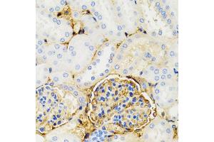 Immunohistochemistry of paraffin-embedded mouse kidney using GALT antibody.