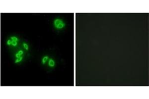 Immunofluorescence analysis of A549 cells, using TFIP8 Antibody  . (TNFAIP8 抗体)