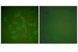 Immunofluorescence (IF) image for anti-Secretoglobin, Family 2A, Member 2 (SCGB2A2) antibody (ABIN7181902)