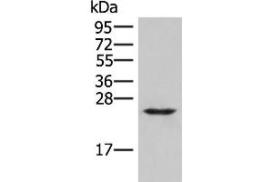 Western blot analysis of Human fetal brain tissue lysate using MRAS Polyclonal Antibody at dilution of 1:400 (MRAS 抗体)