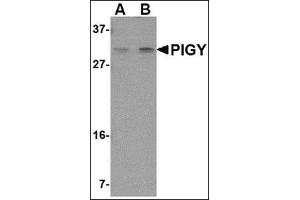 Western blot analysis of PIG-Y in human spleen tissue lysate with this product at (A) 1 and (B) 2 μg/ml. (PIGY 抗体  (Center))