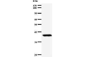 Western Blotting (WB) image for anti-Paired Box 6 (PAX6) antibody (ABIN930925) (PAX6 抗体)