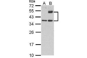 WB Image Sample (30 ug of whole cell lysate) A: HeLa (control)  B: HeLa treat tunicamycin (4ug/ml) 12% SDS PAGE antibody diluted at 1:500 (ATF4 抗体)